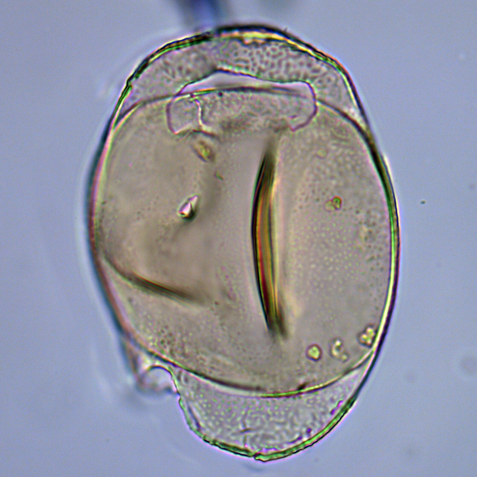 Isabelidinium cretaceum, U1581-22R-6W, 8-13, sl. 1, N32, foto-d.jpg